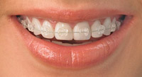 ortodontiya