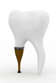 protezirovannie-zubov