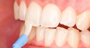 минерализация зубов